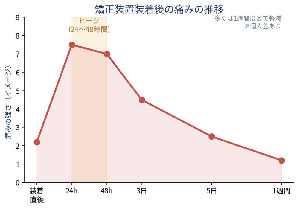 ![矯正装置装着後の痛みの強さの推移を示す折れ線グラフ。横軸が経過時間（装着直後・24〜48時間・3日・1週間）、縦軸が痛みの強さ。24〜48時間でピークになり、その後1週間で大きく低下する曲線。個人差がある旨の注記付き。]