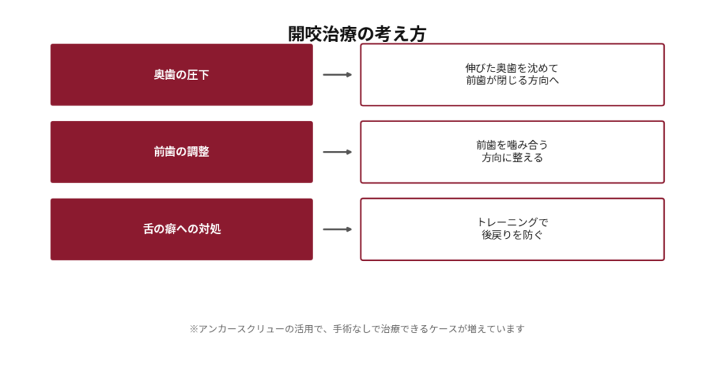 開咬(前歯が閉じない)治療の考え方を示した図。奥歯の圧下により伸びた奥歯を沈めて前歯が閉じる方向へ導く。前歯の調整で前歯を噛み合う方向に整える。舌の癖にはトレーニングで対処して後戻りを防ぐ。アンカースクリューの活用により、手術なしで治療できるケースが増えている旨を注記。