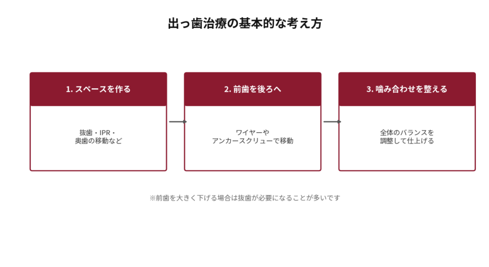 出っ歯治療の基本的な考え方を3ステップで示した図。1.スペースを作る（抜歯・IPR・奥歯の移動など）、2.前歯を後ろへ（ワイヤーやアンカースクリューで移動）、3.噛み合わせを整える（全体のバランスを調整して仕上げる）。前歯を大きく下げる場合は抜歯が必要になることが多い旨を注記。