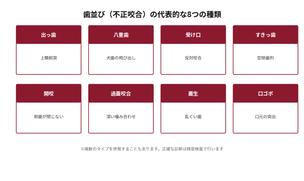 歯並び(不正咬合)の代表的な8つの種類を一覧にした図。出っ歯(上顎前突)、八重歯(犬歯の飛び出し)、受け口(反対咬合)、すきっ歯(空隙歯列)、開咬(前歯が閉じない)、過蓋咬合(深い噛み合わせ)、叢生(乱ぐい歯)、口ゴボ(口元の突出)を並べて示す。複数のタイプを併発することもあり、正確な診断は精密検査で行う旨を注記。