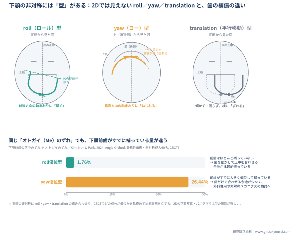 下顎非対称の3つの型と歯の補償の違いを示す図。上段：roll型は正面から見て下顎が前後軸まわりに傾き咬合平面も傾く、yaw型は上から見て下顎が垂直軸まわりにねじれ前歯が横に振れる、translation型は傾かず横にずれる。下段：下顎前歯の正中のずれがオトガイのずれに占める割合はroll優位型1.76%、yaw優位型26.44%で、yaw型は歯だけで正中を合わせる余地が少ない（Kim, Noh & Park 2024）