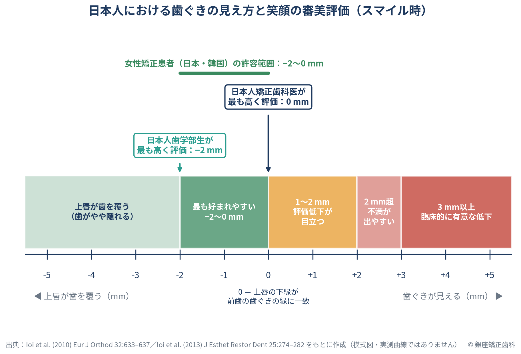 日本人における歯ぐきの見え方と笑顔の審美評価を示す模式図。横軸は上唇が歯を覆う−5mmから歯ぐきが見える＋5mmまで。−2〜0mmが最も好まれやすい緑のゾーン、1〜2mmで評価低下が目立つ黄色のゾーン、2mm超で不満が出やすく3mm以上で臨床的に有意な低下となる赤いゾーン。日本人矯正歯科医は0mm、歯学部生は−2mmを最も高く評価し、女性矯正患者の許容範囲は−2〜0mmと示されている